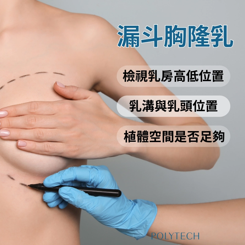 漏斗胸可以隆乳嗎?手術前該怎麼評估?