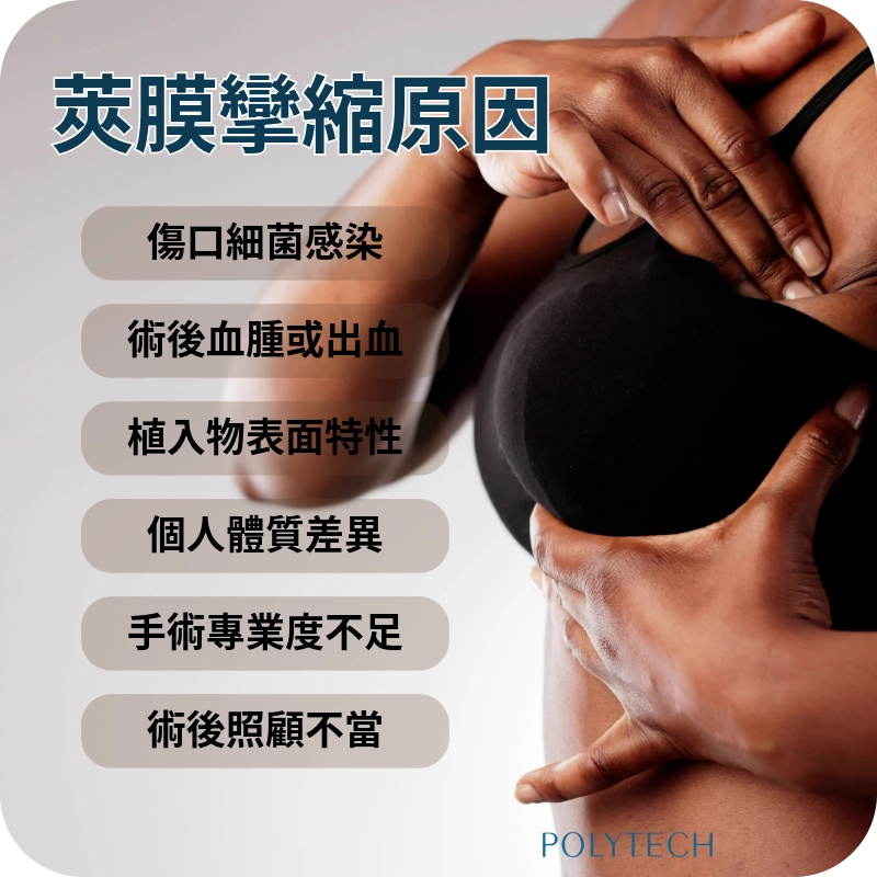莢膜攣縮原因