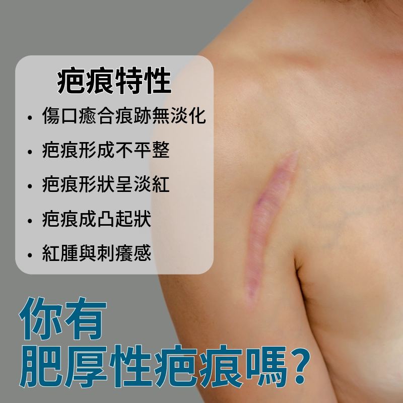認識肥厚性疤痕|什麼是肥厚性疤痕?