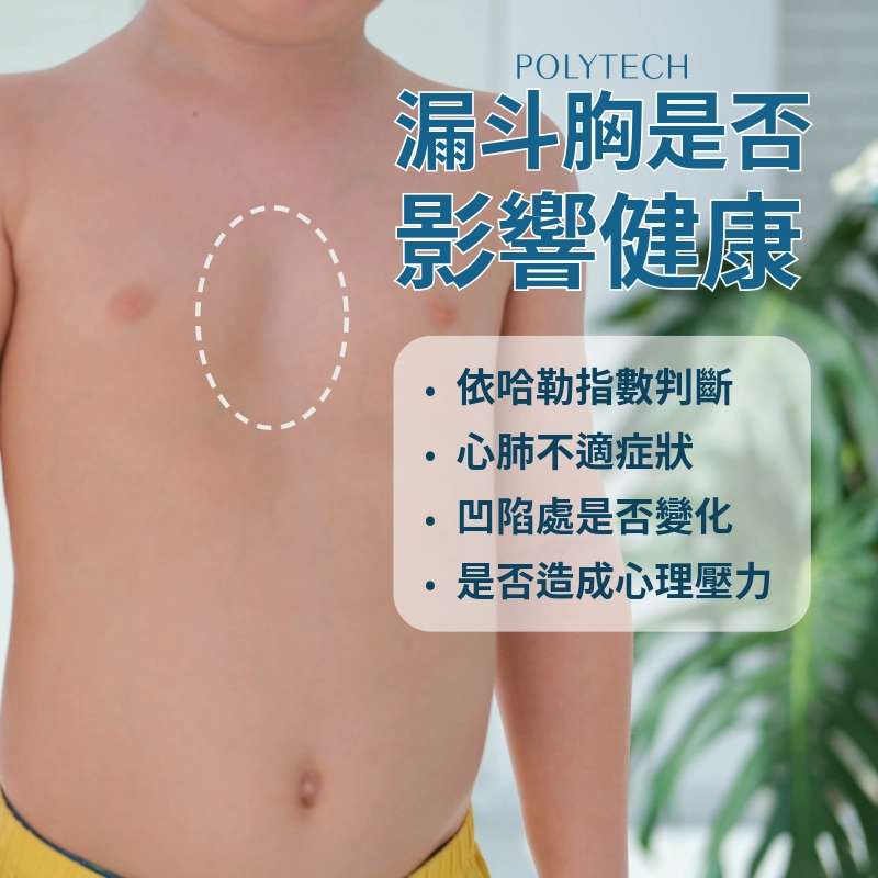 漏斗胸會影響健康嗎?